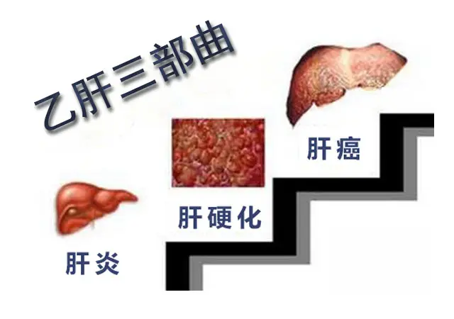 健康人感染乙肝的幾率是多少？